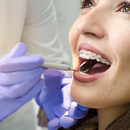 woman wearing braces receiving checkup